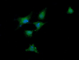 DDX58 / RIG-1 / RIG-I Antibody - Anti-DDX58 mouse monoclonal antibody immunofluorescent staining of COS7 cells transiently transfected by pCMV6-ENTRY DDX58.