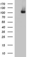 DDX58 / RIG-1 / RIG-I Antibody - HEK293T cells were transfected with the pCMV6-ENTRY control (Left lane) or pCMV6-ENTRY DDX58 (Right lane) cDNA for 48 hrs and lysed. Equivalent amounts of cell lysates (5 ug per lane) were separated by SDS-PAGE and immunoblotted with anti-DDX58.