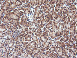 DDX58 / RIG-1 / RIG-I Antibody - IHC of paraffin-embedded Human pancreas tissue using anti-DDX58 mouse monoclonal antibody.