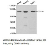 DDX58 / RIG-1 / RIG-I Antibody - Western blot.