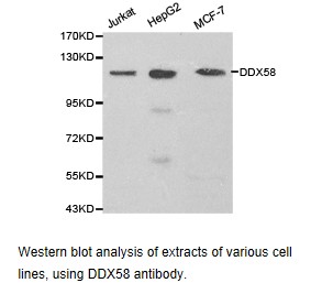 DDX58 / RIG-1 / RIG-I Antibody - Western blot.