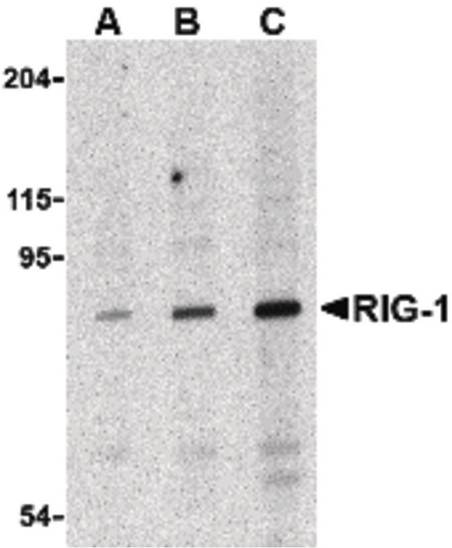 DDX58 / RIG-1 / RIG-I Antibody - Western blot of RIG-1 in C2C12 cell lysate with RIG-1 antibody at (A) 0.5, (B) 1 and (C) 2 ug/ml.