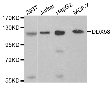 DDX58 / RIG-1 / RIG-I Antibody - Western blot analysis of extracts of various cell lines.