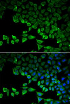 DDX58 / RIG-1 / RIG-I Antibody - Immunofluorescence analysis of HeLa cells.