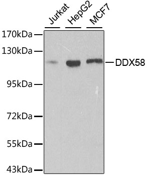 DDX58 / RIG-1 / RIG-I Antibody - Western blot analysis of extracts of various cell lines, using DDX58 antibody at 1:500 dilution. The secondary antibody used was an HRP Goat Anti-Rabbit IgG (H+L) at 1:10000 dilution. Lysates were loaded 25ug per lane and 3% nonfat dry milk in TBST was used for blocking. An ECL Kit was used for detection.