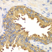 DDX58 / RIG-1 / RIG-I Antibody - Immunohistochemistry of paraffin-embedded human prostate using DDX58 antibodyat dilution of 1:100 (40x lens).