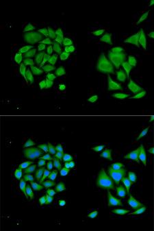 DDX58 / RIG-1 / RIG-I Antibody - Immunofluorescence analysis of HeLa cells using DDX58 antibody. Blue: DAPI for nuclear staining.