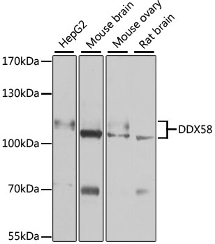 DDX58 / RIG-1 / RIG-I Antibody - Western blot analysis of extracts of various cell lines, using DDX58 antibody at 1:1000 dilution. The secondary antibody used was an HRP Goat Anti-Rabbit IgG (H+L) at 1:10000 dilution. Lysates were loaded 25ug per lane and 3% nonfat dry milk in TBST was used for blocking. An ECL Kit was used for detection and the exposure time was 90s.