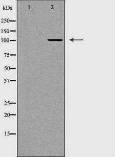 DDX58 / RIG-1 / RIG-I Antibody - Western blot analysis of mouse heart lysate using DDX58 antibody. The lane on the left is treated with the antigen-specific peptide.