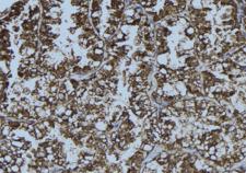 DDX58 / RIG-1 / RIG-I Antibody - 1:100 staining mouse testis tissue by IHC-P. The sample was formaldehyde fixed and a heat mediated antigen retrieval step in citrate buffer was performed. The sample was then blocked and incubated with the antibody for 1.5 hours at 22°C. An HRP conjugated goat anti-rabbit antibody was used as the secondary.