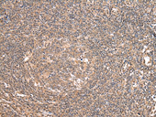 DDX58 / RIG-1 / RIG-I Antibody - Immunohistochemistry of paraffin-embedded Human tonsil tissue  using DDX58 Polyclonal Antibody at dilution of 1:35(×200)