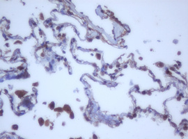 DDX59 Antibody - IHC of paraffin-embedded Human lung tissue using anti-DDX59 mouse monoclonal antibody.