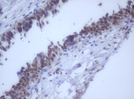 DDX59 Antibody - IHC of paraffin-embedded Human bladder tissue using anti-DDX59 mouse monoclonal antibody.