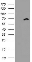 DDX59 Antibody - HEK293T cells were transfected with the pCMV6-ENTRY control (Left lane) or pCMV6-ENTRY DDX59 (Right lane) cDNA for 48 hrs and lysed. Equivalent amounts of cell lysates (5 ug per lane) were separated by SDS-PAGE and immunoblotted with anti-DDX59.