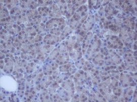 DDX59 Antibody - IHC of paraffin-embedded Human pancreas tissue using anti-DDX59 mouse monoclonal antibody.