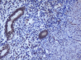 DDX59 Antibody - IHC of paraffin-embedded Human endometrium tissue using anti-DDX59 mouse monoclonal antibody.