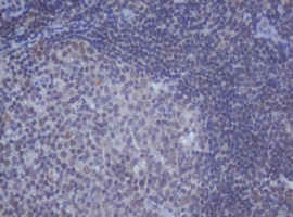 DDX59 Antibody - IHC of paraffin-embedded Human lymph node tissue using anti-DDX59 mouse monoclonal antibody.