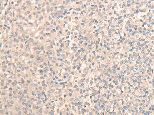 DDX59 Antibody - Immunohistochemistry of paraffin-embedded Human tonsil tissue  using DDX59 Polyclonal Antibody at dilution of 1:30(×200)