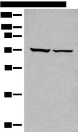 DDX59 Antibody - Western blot analysis of 293T cell lysates  using DDX59 Polyclonal Antibody at dilution of 1:500