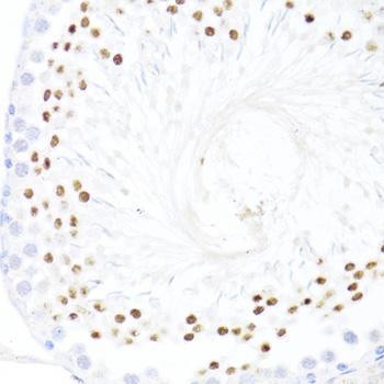 DDX59 Antibody - Immunohistochemistry of paraffin-embedded Rat testis using DDX59 Polyclonal Antibody at dilution of 1:100 (40x lens).