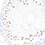 DDX59 Antibody - Immunohistochemistry of paraffin-embedded Rat testis using DDX59 Polyclonal Antibody at dilution of 1:100 (40x lens).
