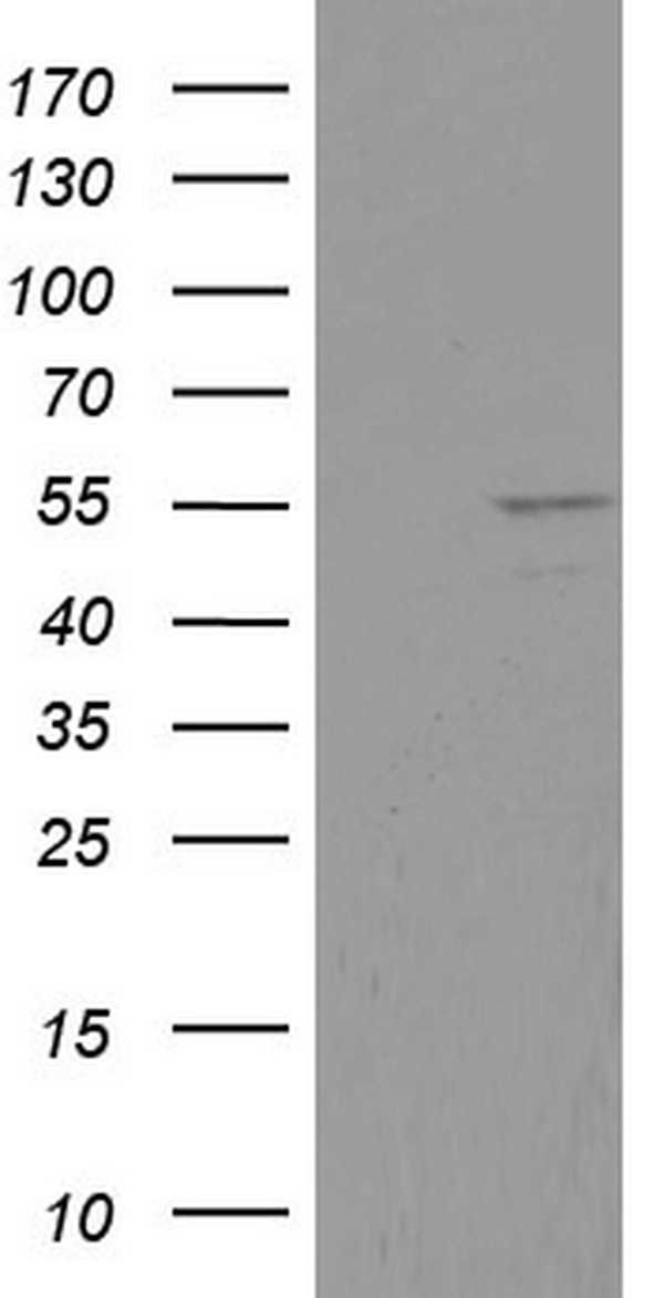 DDX6 Antibody - HEK293T cells were transfected with the pCMV6-ENTRY control. (Left lane) or pCMV6-ENTRY DDX6. (Right lane) cDNA for 48 hrs and lysed. Equivalent amounts of cell lysates. (5 ug per lane) were separated by SDS-PAGE and immunoblotted with anti-DDX6.