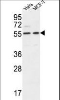 DDX6 Antibody - DDX6 Antibody western blot of HeLa,MCF-7 cell line lysates (35 ug/lane). The DDX6 antibody detected the DDX6 protein (arrow).