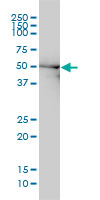 DDX6 Antibody - DDX6 monoclonal antibody (M01), clone 3D2 Western blot of DDX6 expression in HeLa.