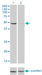 DDX6 Antibody - Western blot of DDX6 over-expressed 293 cell line, cotransfected with DDX6 Validated Chimera RNAi (Lane 2) or non-transfected control (Lane 1). Blot probed with DDX6 monoclonal antibody, clone 3D2. GAPDH ( 36.1 kD ) used as specificity an.