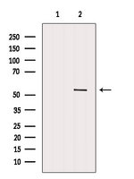 DDX6 Antibody - Western blot analysis of extracts of HuvEc cells using DDX6 antibody. The lane on the left was treated with blocking peptide.