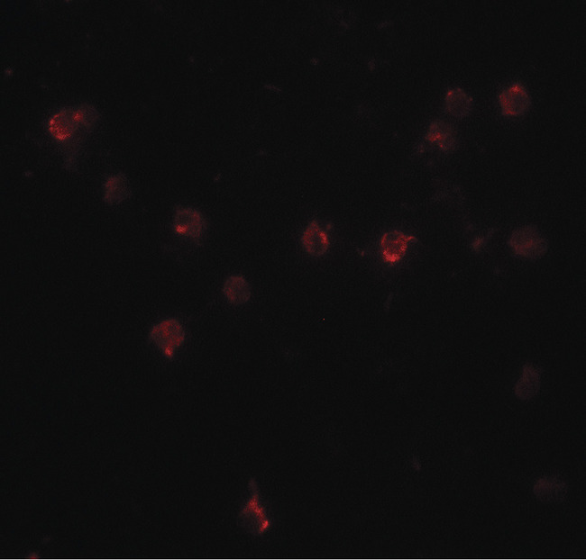 DDX60 Antibody - Immunofluorescence of DDX60 in A20 cells with DDX60 antibody at 20 ug/ml.