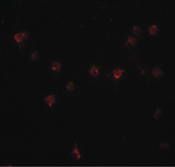 DDX60 Antibody - Immunofluorescence of DDX60 in A20 cells with DDX60 antibody at 20 ug/ml.