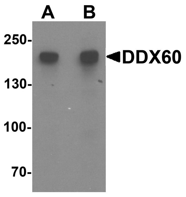 DDX60 Antibody - Western blot analysis of DDX60 in A20 cell lysate with DDX60 antibody at (A) 1 and (B) 2 ug/ml.