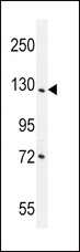 DDX60L Antibody - DDX60L Antibody western blot of NCI-H292 cell line lysates (35 ug/lane). The DDX60L antibody detected the DDX60L protein (arrow).