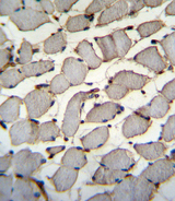 DDX60L Antibody - DDX60L Antibody immunohistochemistry of formalin-fixed and paraffin-embedded human skeletal muscle followed by peroxidase-conjugated secondary antibody and DAB staining.