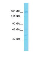 DDX60L Antibody - Western blot of DDX60L Antibody - N-terminal region with human PANC1 cells lysate.  This image was taken for the unconjugated form of this product. Other forms have not been tested.