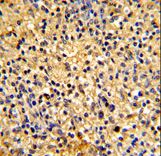 DEC-205 / CD205 / LY75 Antibody - Formalin-fixed and paraffin-embedded human spleen tissue reacted with LY75 Antibody , which was peroxidase-conjugated to the secondary antibody, followed by DAB staining. This data demonstrates the use of this antibody for immunohistochemistry; clinical relevance has not been evaluated.