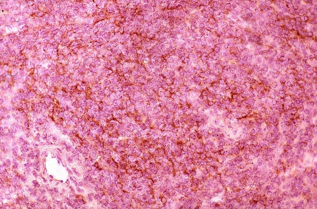 DEC-205 / CD205 / LY75 Antibody - Immunoperoxidase staining of cryosectioned mouse lymph node with Rat anti-Mouse CD205.  This image was taken for the unconjugated form of this product. Other forms have not been tested.