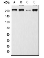 DEC-205 / CD205 / LY75 Antibody - Western blot analysis of CD205 expression in MCF7 (A); SP2/0 (B); H9C2 (C); mouse lymph node (D) whole cell lysates.