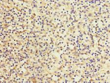 DEC-205 / CD205 / LY75 Antibody - Immunohistochemistry of paraffin-embedded human spleen tissue at dilution 1:100
