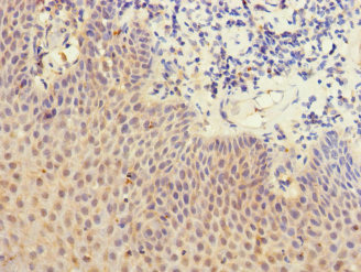 DEC-205 / CD205 / LY75 Antibody - Immunohistochemistry of paraffin-embedded human tonsil tissue at dilution 1:100