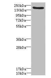 DEC-205 / CD205 / LY75 Antibody - Western blot All Lanes: LY75 antibody IgG at 1.57ug/ml+ Mouse liver tissue Secondary Goat polyclonal to rabbit IgG at 1/10000 dilution Predicted band size: 199,216,20,210 kDa Observed band size: 198 kDa