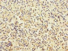 DEC-205 / CD205 / LY75 Antibody - Immunohistochemistry of paraffin-embedded human spleen tissue at dilution 1:100