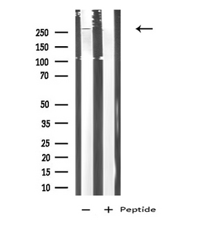 DEC-205 / CD205 / LY75 Antibody - Western blot analysis of extracts of COLO205 cells using LY75 antibody.