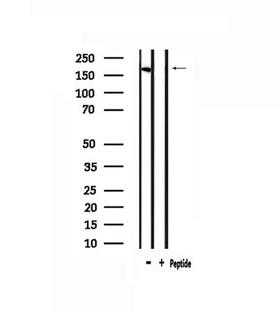 DEC-205 / CD205 / LY75 Antibody - Western blot analysis of extracts of mouse brain tissue using LY75 antibody.