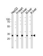 DECR1 Antibody - Western blot of lysates from HepG2 cell line, human heart, human liver, mouse liver, rat liver tissue lysate (from left to right), using DECR1 antibody diluted at 1:1000 at each lane. A goat anti-rabbit IgG H&L (HRP) at 1:10000 dilution was used as the secondary antibody. Lysates at 20 ug per lane.