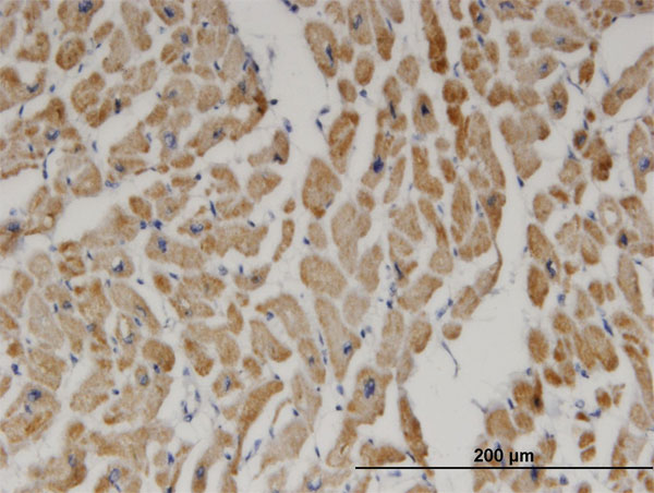 DECR1 Antibody - Immunoperoxidase of monoclonal antibody to DECR1 on formalin-fixed paraffin-embedded human heart. [antibody concentration 3 ug/ml]