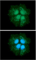 DECR1 Antibody - ICC/IF analysis of DECR1 in Hep3B cells line, stained with DAPI (Blue) for nucleus staining and monoclonal anti-human DECR1 antibody (1:100) with goat anti-mouse IgG-Alexa fluor 488 conjugate (Green).