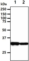 DECR1 Antibody - The cell lysates (40ug) were resolved by SDS-PAGE, transferred to PVDF membrane and probed with anti-human DECR1 antibody (1:1000). Proteins were visualized using a goat anti-mouse secondary antibody conjugated to HRP and an ECL detection system. Lane 1.: PC3 cell lysate Lane 2.: HepG2 cell lysate