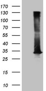 DECR1 Antibody - HEK293T cells were transfected with the pCMV6-ENTRY control. (Left lane) or pCMV6-ENTRY DECR1. (Right lane) cDNA for 48 hrs and lysed